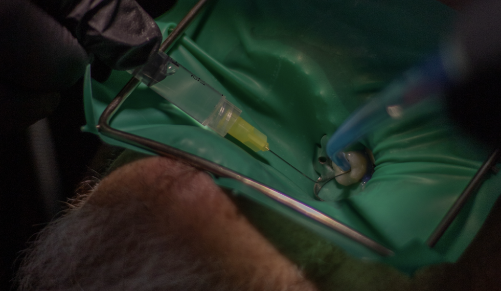 "dolor dental intenso puente alto", "endodoncia","tratamiento de conducto"